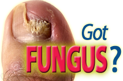 Got toenail fungus?